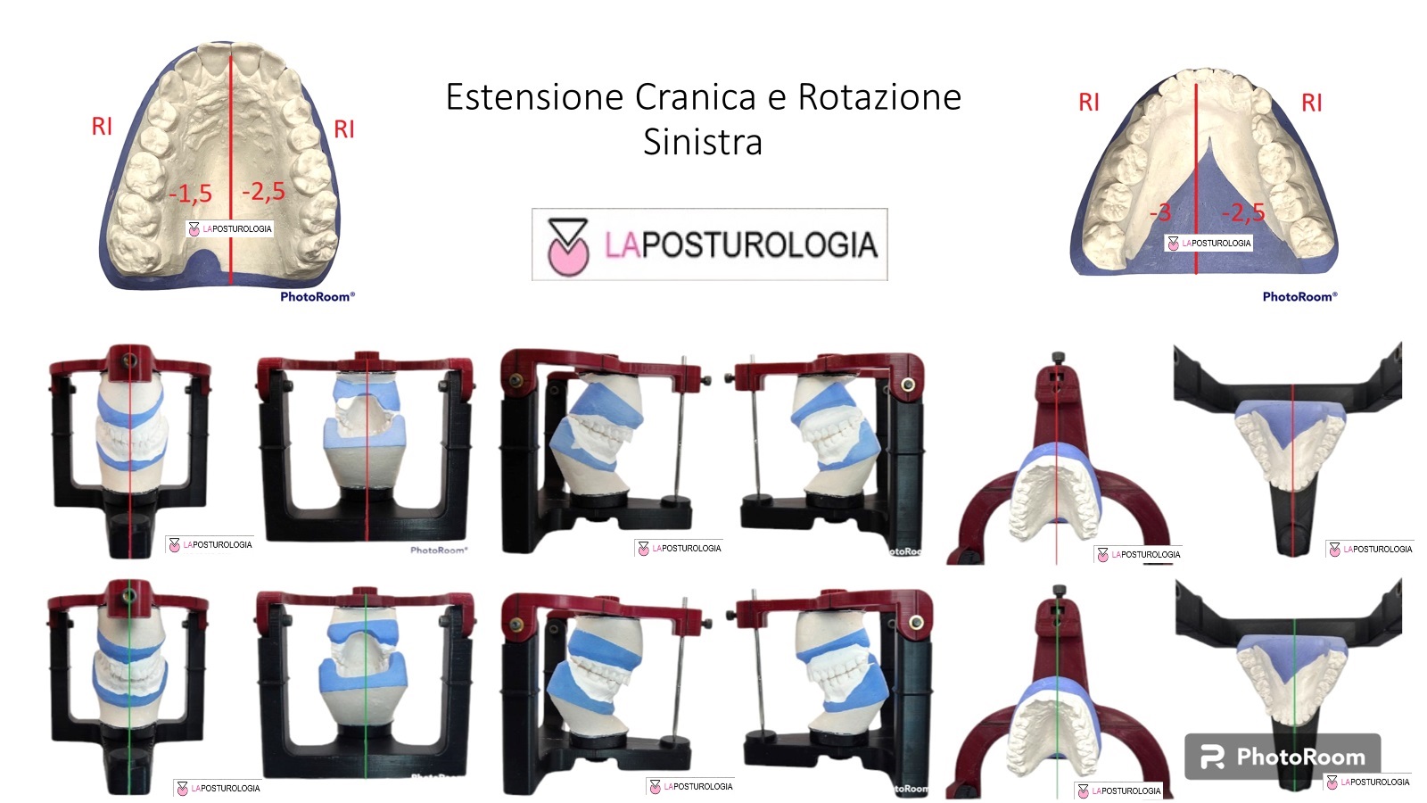 Adattamenti della base Cranica Adattamenti della base Cranica