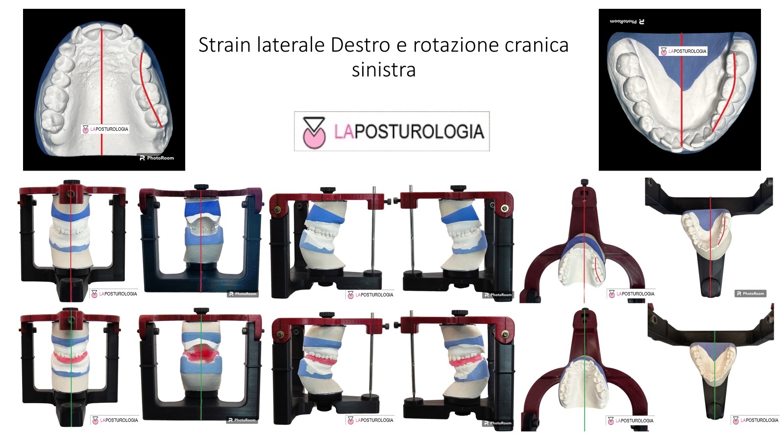 Strain Laterale