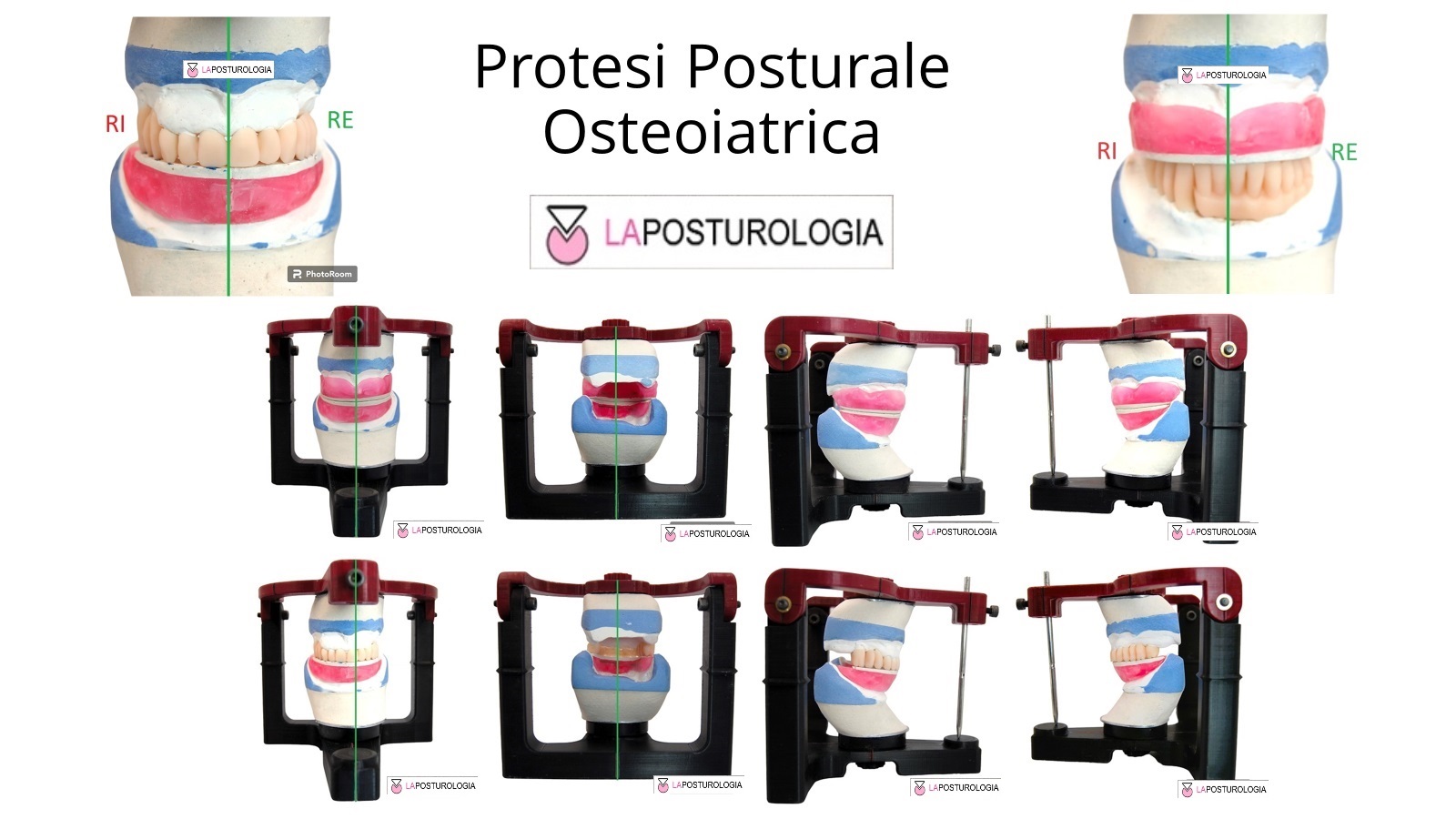 Protesi Posturale Osteoiatrica