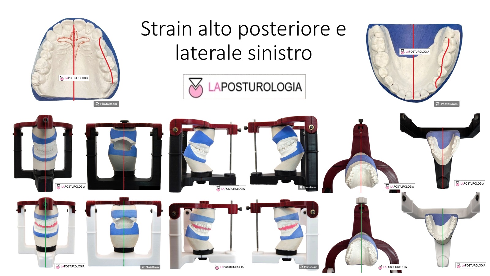 Strain Laterale