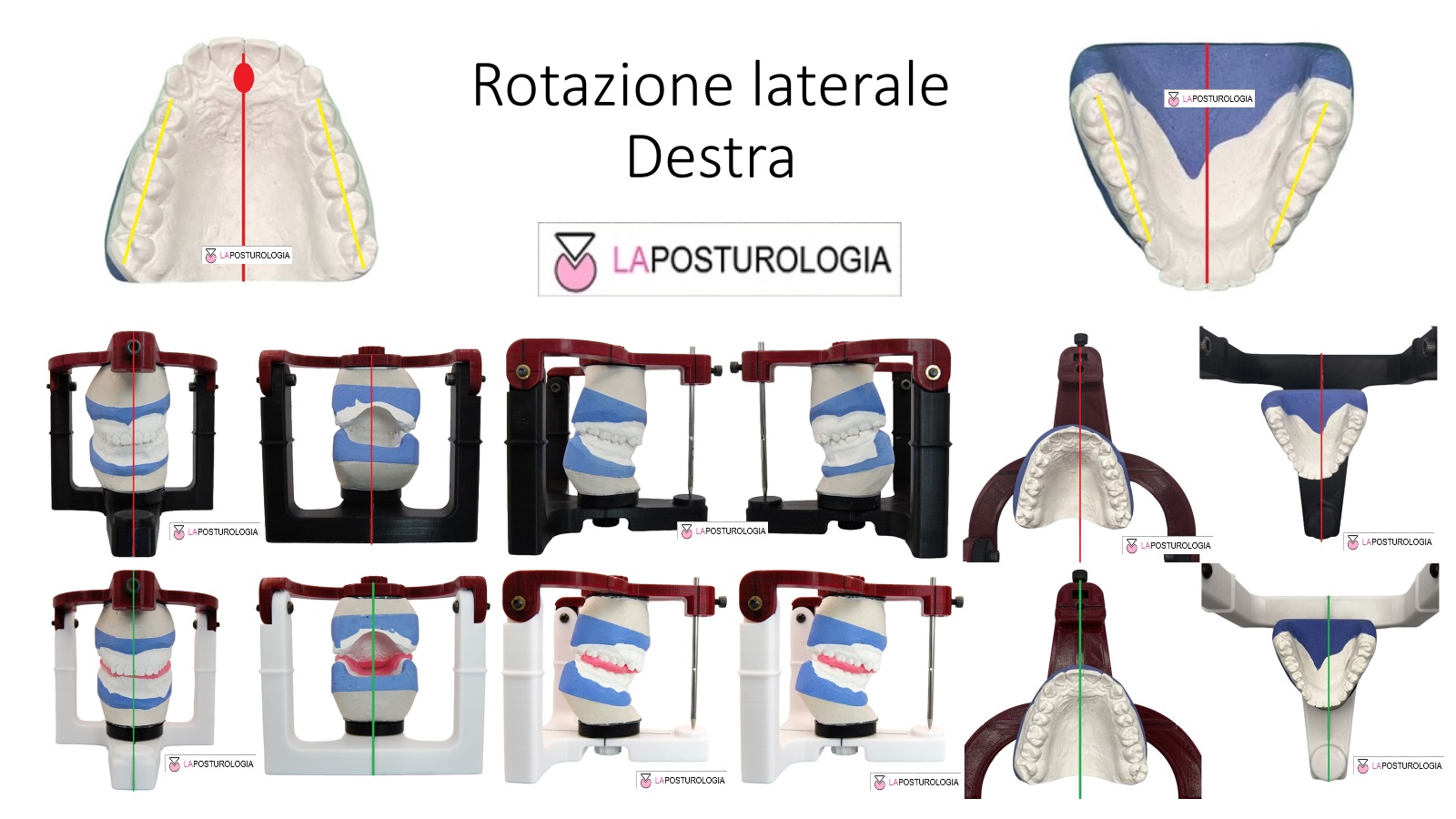 Rotazione laterale Rotazione laterale