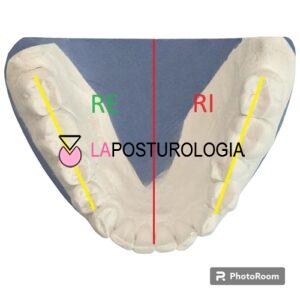 latero-flessione-side-bending