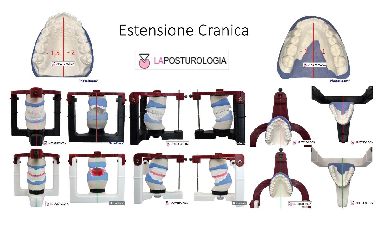 Flessione e Estensione Cranica