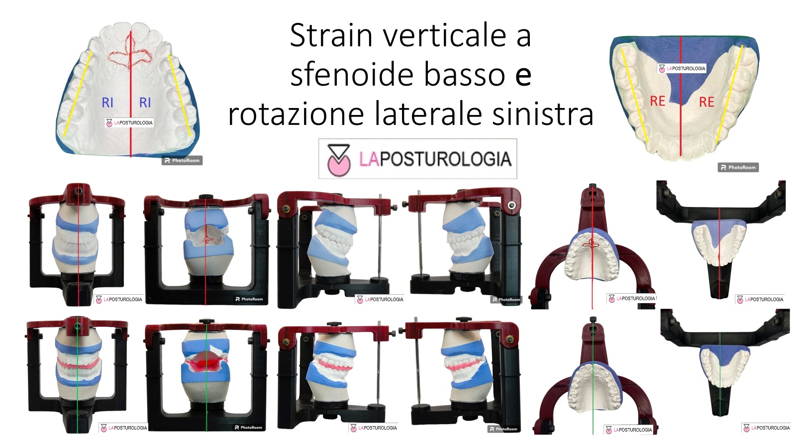 strain-verticale