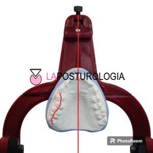 Strain laterale