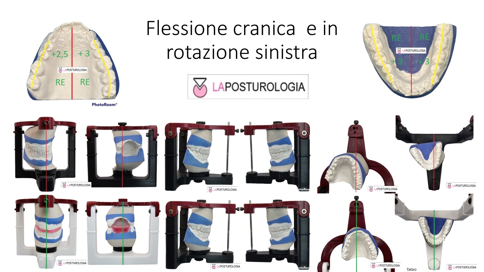 Adattamenti della base Cranica Adattamenti della base Cranica