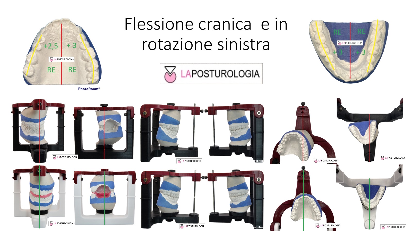 Flessione e Estensione Cranica
