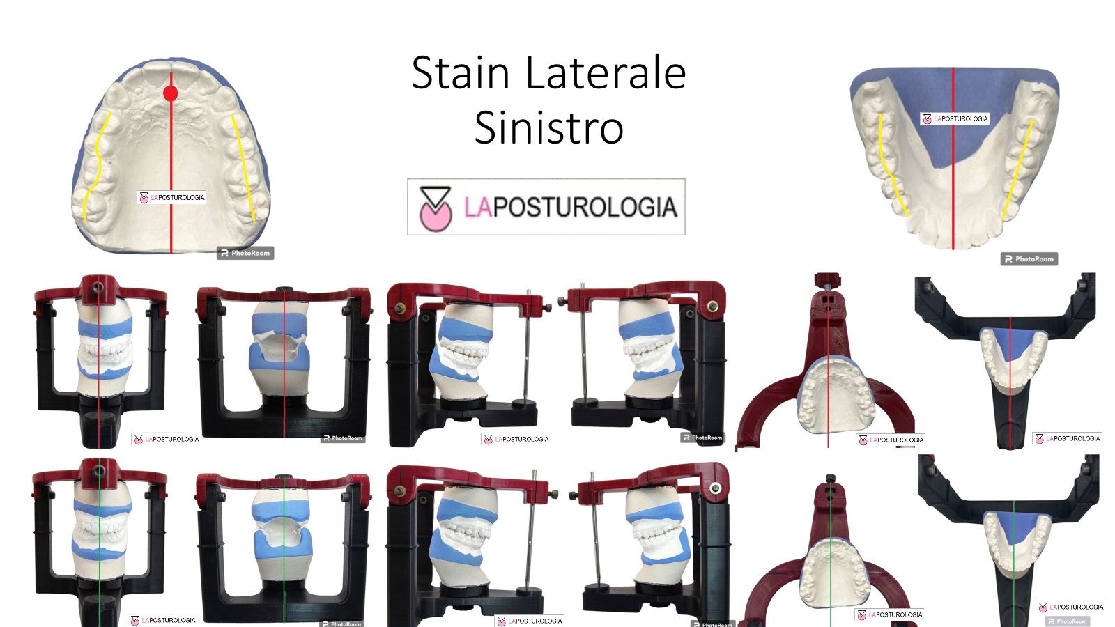 Strain Laterale