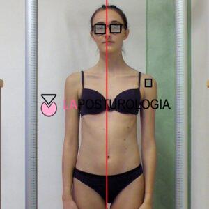 Agenesie dentali e posturali