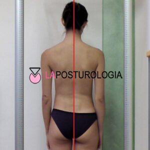 Agenesie dentali e posturali