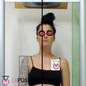 Piercing linguali danni posturali