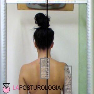 Piercing linguali danni posturali